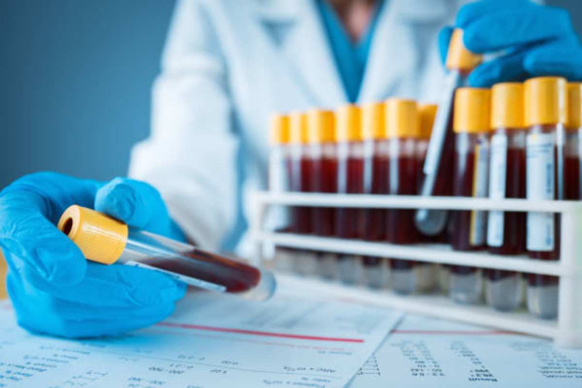 Test del sangue per diagnosi precoce Parkinson
